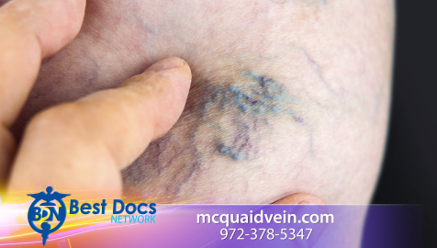 McQuaid Vein Specialists Opens New Location in Southlake, TX